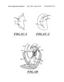 HYDRAULIC DELIVERY SYSTEMS FOR PROSTHETIC HEART VALVE DEVICES AND     ASSOCIATED METHODS diagram and image