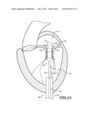 HYDRAULIC DELIVERY SYSTEMS FOR PROSTHETIC HEART VALVE DEVICES AND     ASSOCIATED METHODS diagram and image