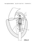 HYDRAULIC DELIVERY SYSTEMS FOR PROSTHETIC HEART VALVE DEVICES AND     ASSOCIATED METHODS diagram and image