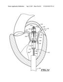 HYDRAULIC DELIVERY SYSTEMS FOR PROSTHETIC HEART VALVE DEVICES AND     ASSOCIATED METHODS diagram and image
