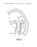 HYDRAULIC DELIVERY SYSTEMS FOR PROSTHETIC HEART VALVE DEVICES AND     ASSOCIATED METHODS diagram and image