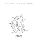 HYDRAULIC DELIVERY SYSTEMS FOR PROSTHETIC HEART VALVE DEVICES AND     ASSOCIATED METHODS diagram and image