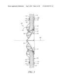 INTRA-ATRIAL IMPLANTS MADE OF NON-BRAIDED MATERIAL diagram and image