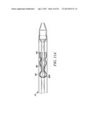 INTRA-ATRIAL IMPLANTS MADE OF NON-BRAIDED MATERIAL diagram and image