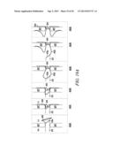 INTRA-ATRIAL IMPLANTS MADE OF NON-BRAIDED MATERIAL diagram and image