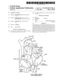 ARTIFICIAL HEART diagram and image