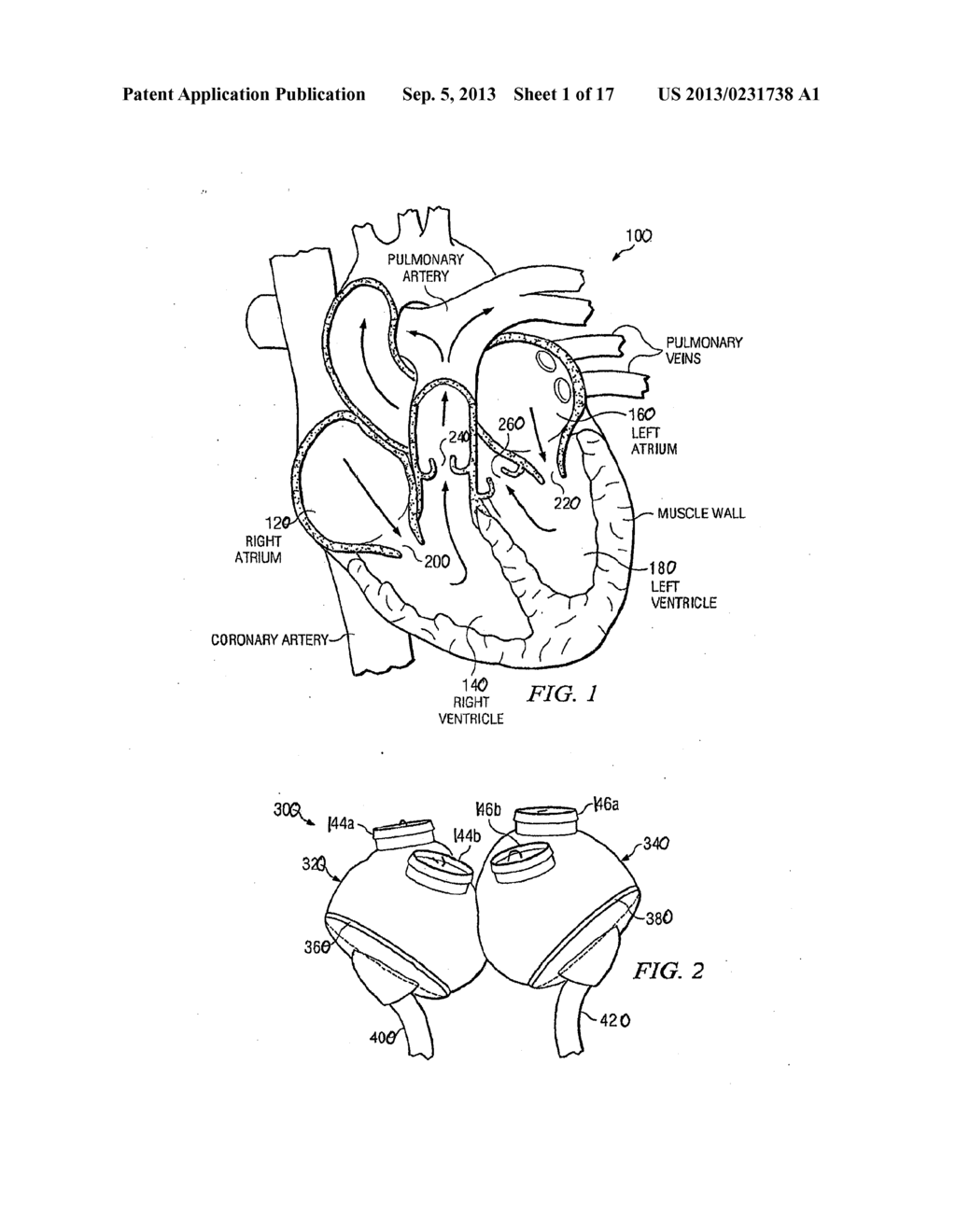 ARTIFICIAL HEART - diagram, schematic, and image 02