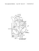 ARTIFICIAL HEART diagram and image