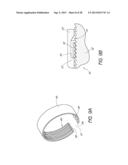 INTERVERTEBRAL IMPLANT diagram and image