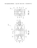 INTERVERTEBRAL IMPLANT diagram and image