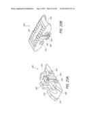 INTERVERTEBRAL IMPLANT diagram and image