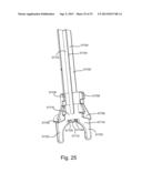 SYSTEM AND METHOD FOR INTERVERTEBRAL IMPLANT DELIVERY AND REMOVAL diagram and image