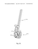 SYSTEM AND METHOD FOR INTERVERTEBRAL IMPLANT DELIVERY AND REMOVAL diagram and image