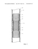 ENDOLUMINAL PROSTHESIS HAVING ANTI-MIGRATION COATING diagram and image