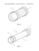 ENDOLUMINAL PROSTHESIS HAVING ANTI-MIGRATION COATING diagram and image