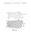 Protective Pad Using A Damping Component diagram and image