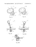 MATERIAL COLLECTION AND IDENTIFICATION DEVICE diagram and image