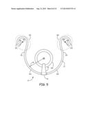 MEANS TO ATTACH GETTER TO GETTER RETAINING RING diagram and image