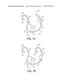 MEANS TO ATTACH GETTER TO GETTER RETAINING RING diagram and image