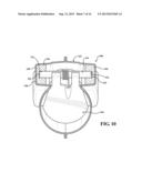 Exhaust Valve Assembly diagram and image