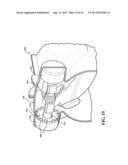 Exhaust Valve Assembly diagram and image