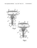 FASTENING ARRANGEMENT OF A FUEL SUPPLY DEVICE ON AN INTERNAL COMBUSTION     ENGINE diagram and image