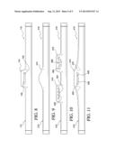 Hiccup Relief Device and Method diagram and image