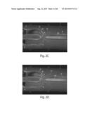 Multichannel Preparative Electrophoresis System diagram and image