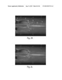 Multichannel Preparative Electrophoresis System diagram and image