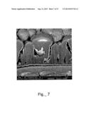 MATERIAL SURFACE TREATMENT METHOD USING CONCURRENT ELECTRICAL AND PHOTONIC     STIMULATION diagram and image