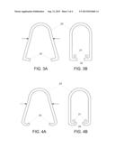 METHOD AND APPARATUS FOR THE INSTALLATION OF A LIFTING LOOP, AND PART     FORMING A LIFTING LOOP diagram and image