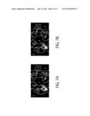 IMAGE PROCESSING DEVICE, IMAGE PROCESSING METHOD AND NON-TRANSITORY     COMPUTER READABLE RECORDING MEDIUM FOR RECORDING IMAGE PROCESSING PROGRAM diagram and image