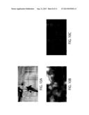 IMAGE PROCESSING DEVICE, IMAGE PROCESSING METHOD AND NON-TRANSITORY     COMPUTER READABLE RECORDING MEDIUM FOR RECORDING IMAGE PROCESSING PROGRAM diagram and image