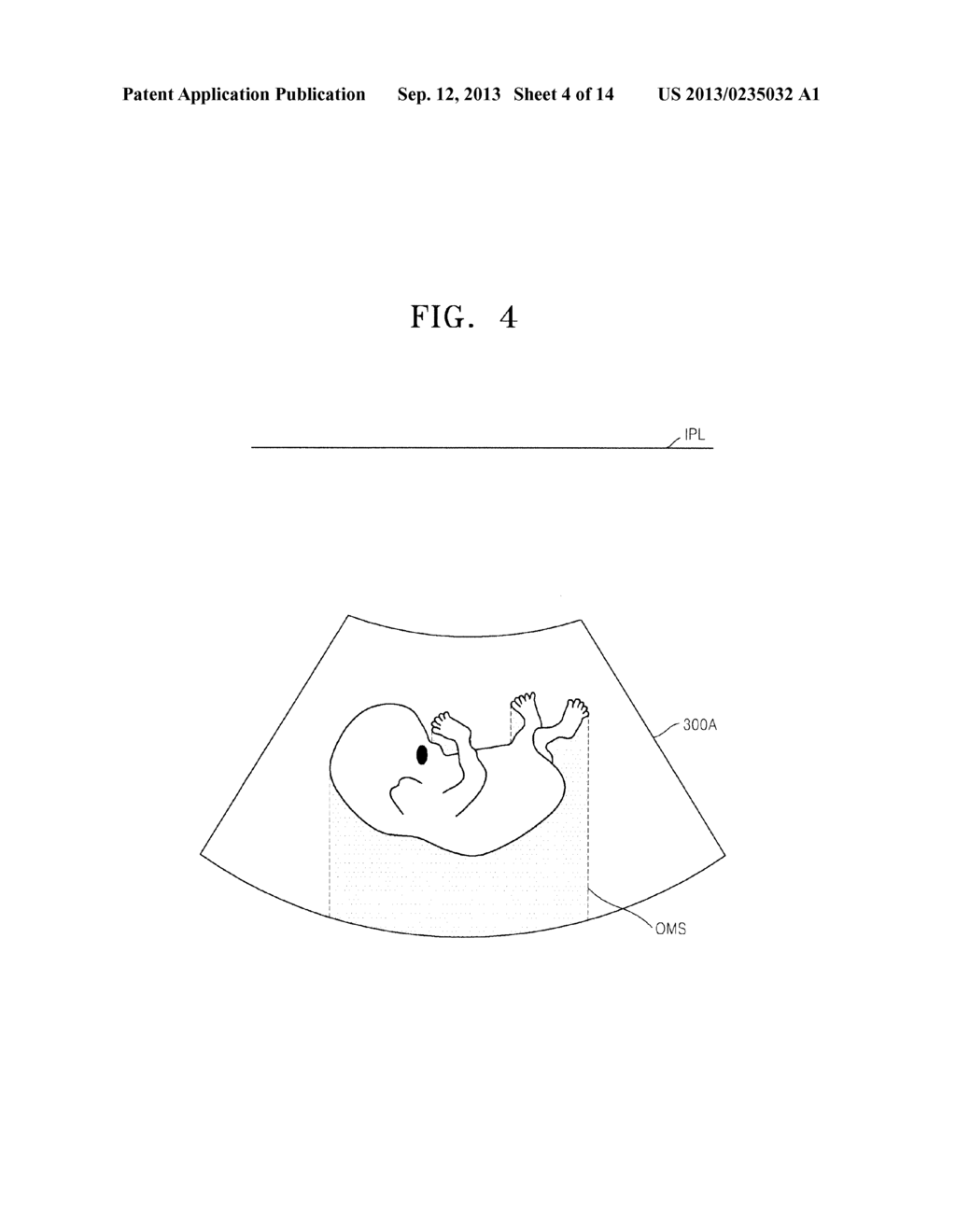 IMAGE PROCESSING APPARATUS AND METHOD - diagram, schematic, and image 05