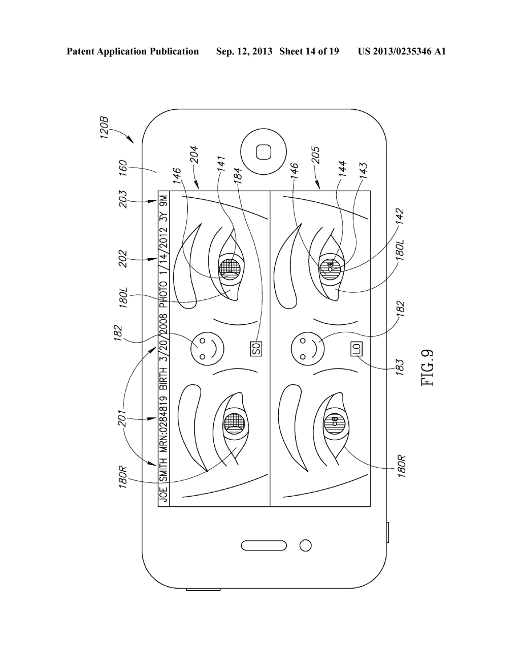 SYSTEM AND METHODS FOR DOCUMENTING AND RECORDING OF THE PUPILLARY RED     REFLEX TEST AND CORNEAL LIGHT REFLEX SCREENING OF THE EYE IN INFANTS AND     YOUNG CHILDREN - diagram, schematic, and image 15