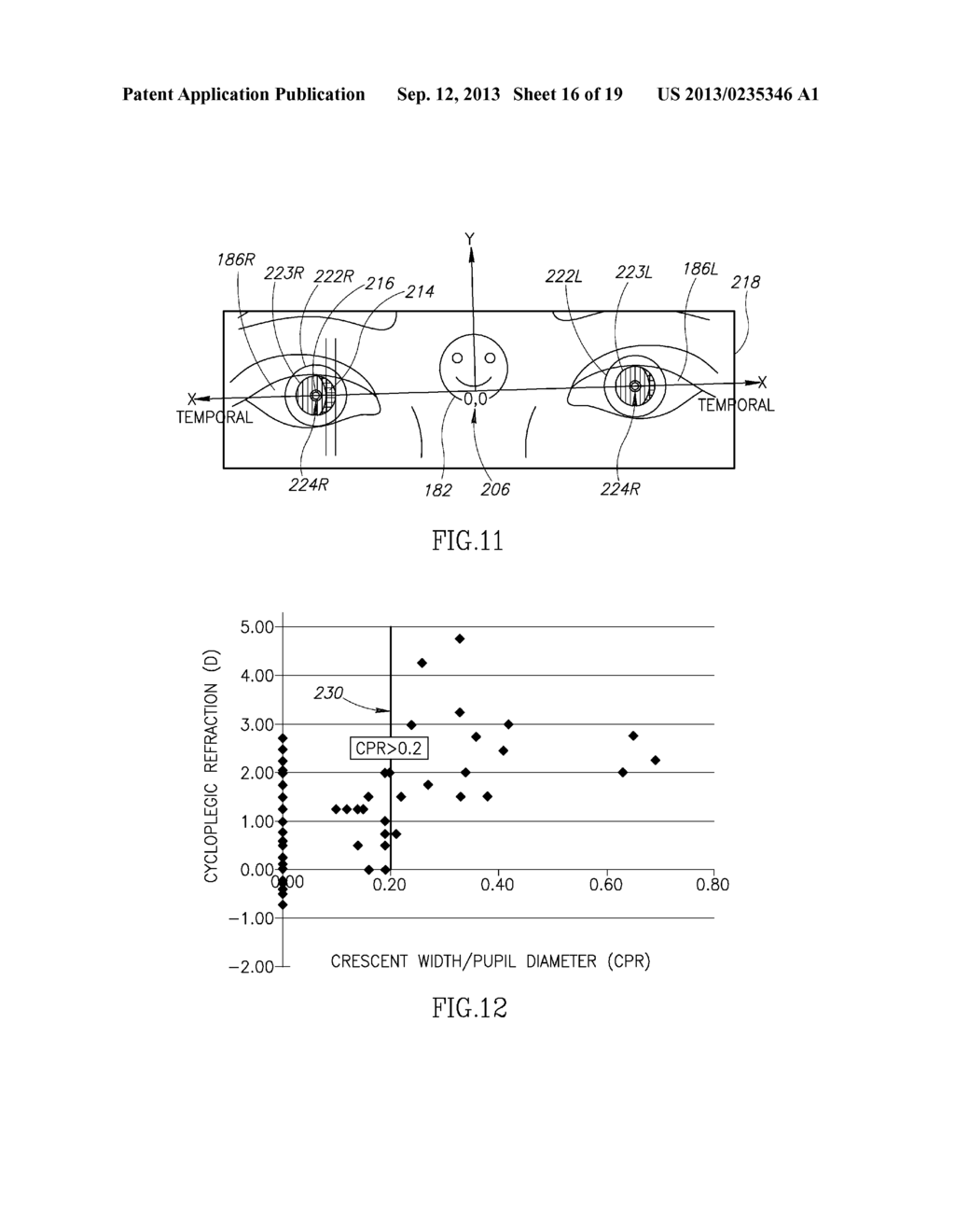 SYSTEM AND METHODS FOR DOCUMENTING AND RECORDING OF THE PUPILLARY RED     REFLEX TEST AND CORNEAL LIGHT REFLEX SCREENING OF THE EYE IN INFANTS AND     YOUNG CHILDREN - diagram, schematic, and image 17