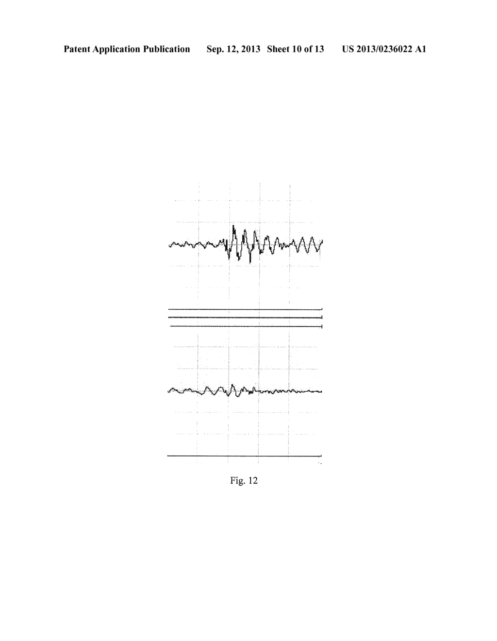 DEVICE AND METHOD FOR POSTPROCESSING A DECODED MULTI-CHANNEL AUDIO SIGNAL     OR A DECODED STEREO SIGNAL - diagram, schematic, and image 11