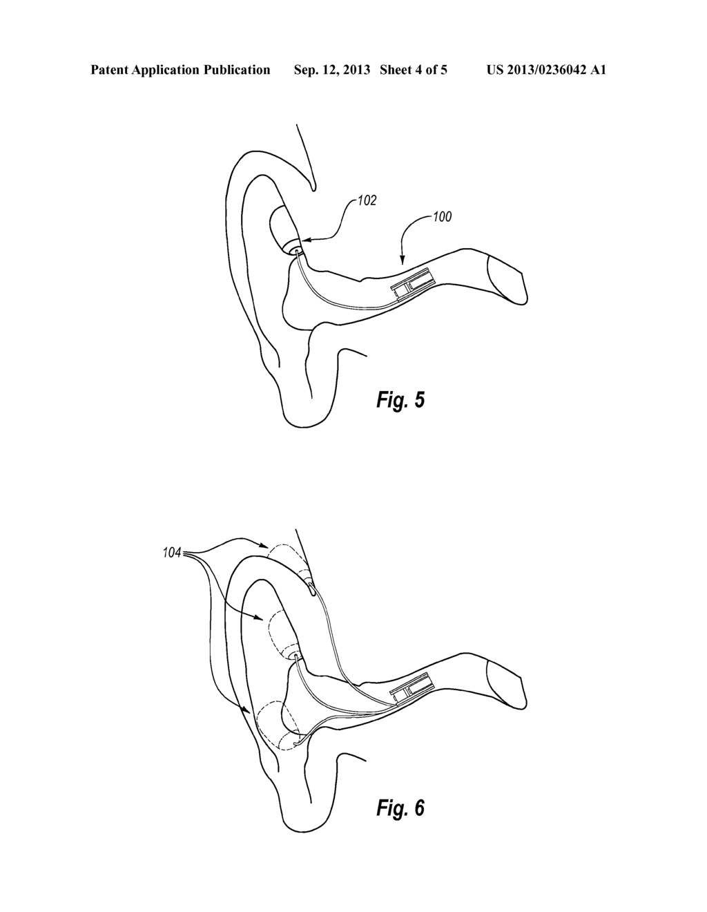 HEARING AID - diagram, schematic, and image 05