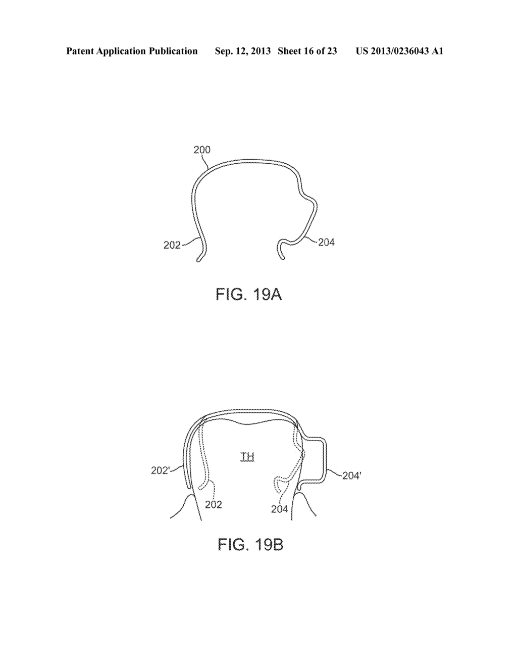 DENTAL BONE CONDUCTION HEARING APPLIANCE - diagram, schematic, and image 17