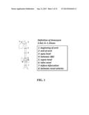 Immunomodulatory Methods and Systems for Treatment and/or Prevention of     Aneurysms diagram and image