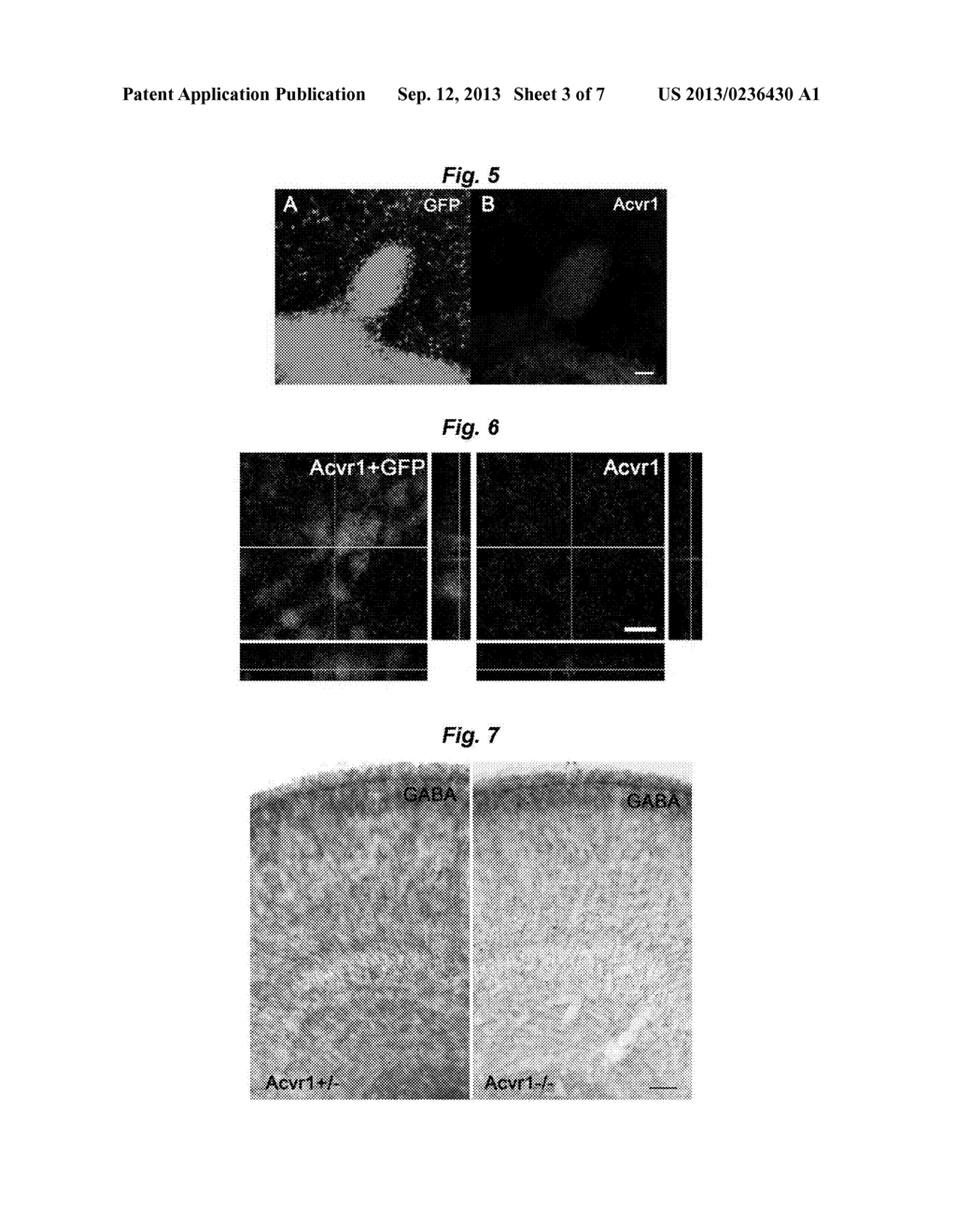 PROLIFERATION, SEPARATION AND TRANSPLANTATION OF INHIBITORY NEURON     PROGENITORS AND PROLIFERATION PROMOTING SUBSTANCES FOR THE PROGENITORS - diagram, schematic, and image 04