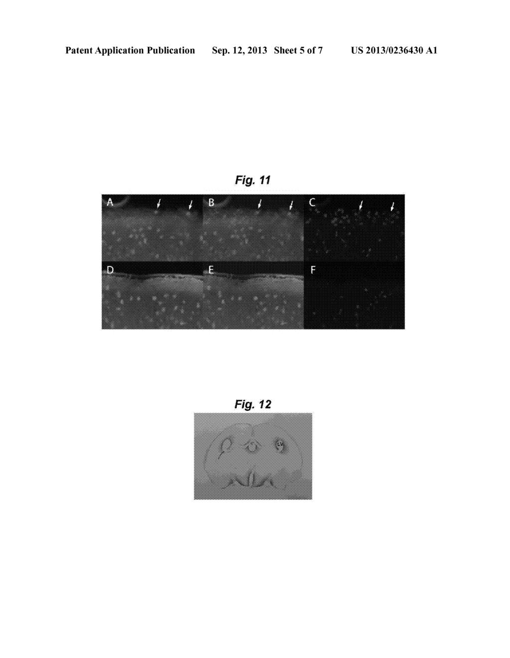 PROLIFERATION, SEPARATION AND TRANSPLANTATION OF INHIBITORY NEURON     PROGENITORS AND PROLIFERATION PROMOTING SUBSTANCES FOR THE PROGENITORS - diagram, schematic, and image 06