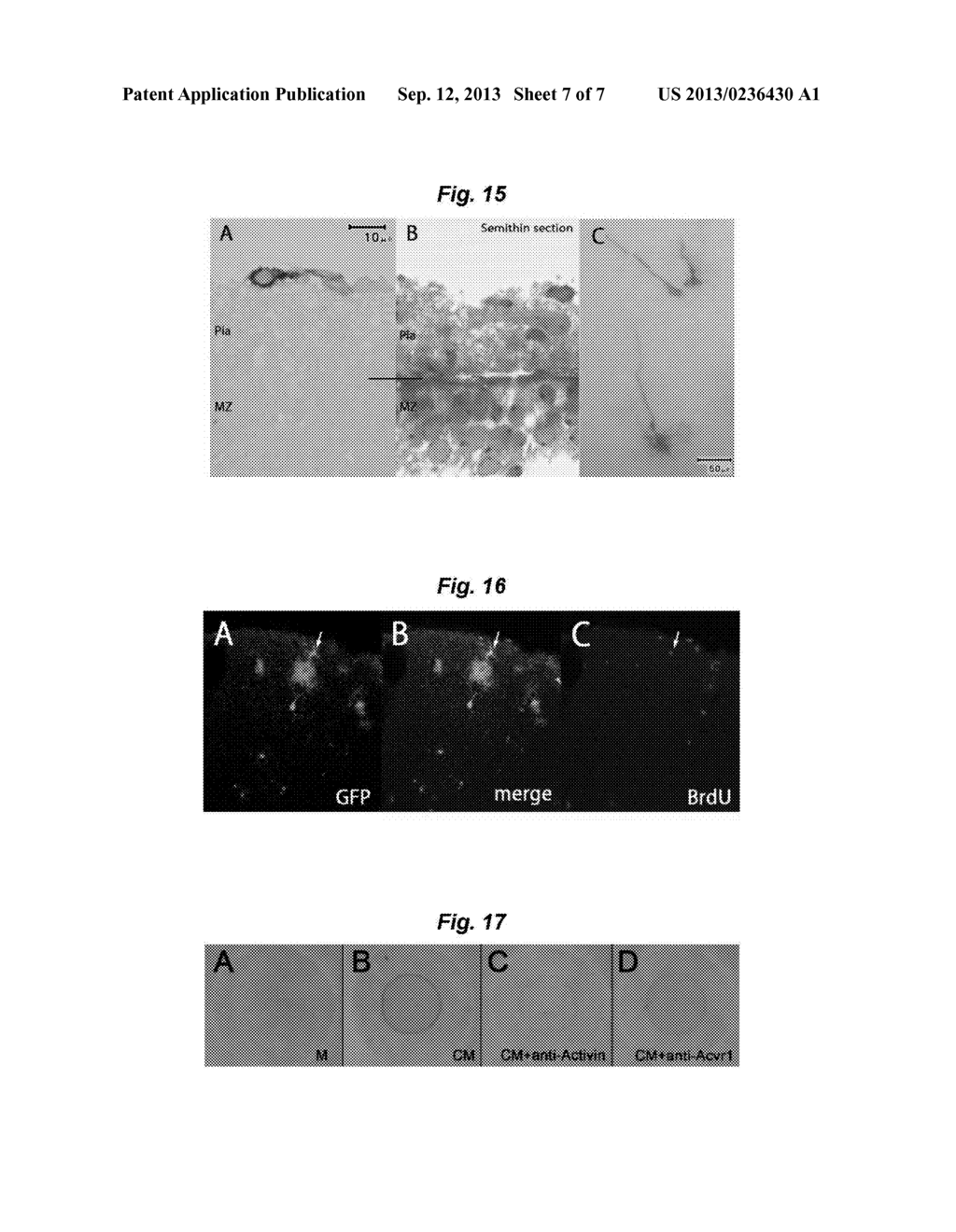 PROLIFERATION, SEPARATION AND TRANSPLANTATION OF INHIBITORY NEURON     PROGENITORS AND PROLIFERATION PROMOTING SUBSTANCES FOR THE PROGENITORS - diagram, schematic, and image 08