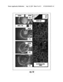 Compositions and Methods for Tissue Engineering, Tissue Regeneration and     Wound Healing diagram and image