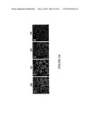 EXPANDABLE CELL SOURCE OF NEURONAL STEM CELL POPULATIONS AND METHODS FOR     OBTAINING AND USNIG THEM diagram and image