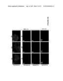 EXPANDABLE CELL SOURCE OF NEURONAL STEM CELL POPULATIONS AND METHODS FOR     OBTAINING AND USNIG THEM diagram and image