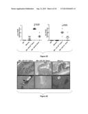 Methods and Compositions for Modulating Acute Graft-versus-Host Disease     using miR-155 Specific Inhibitors diagram and image