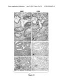 Methods and Compositions for Modulating Acute Graft-versus-Host Disease     using miR-155 Specific Inhibitors diagram and image