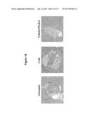 ANTI-CLTA4, ANTI-GLUT2 PROTEIN FOR THE TREATMENT OF TYPE 1 DIABETES diagram and image