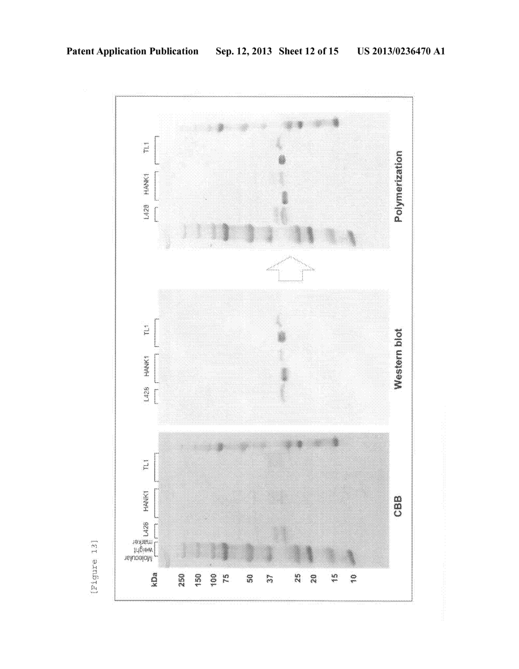 THERAPEUTIC AGENT FOR MALIGNANT TUMORS EXPRESSING MHC CLASS II - diagram, schematic, and image 13